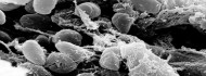 Photo of A pestis legősibb áldozataira bukkantak